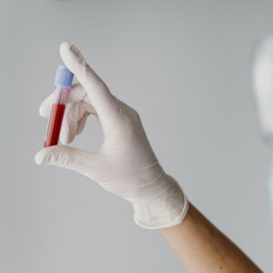 Tubo de ensayo con muestra de sangre para exámenes clínicos veterinarios